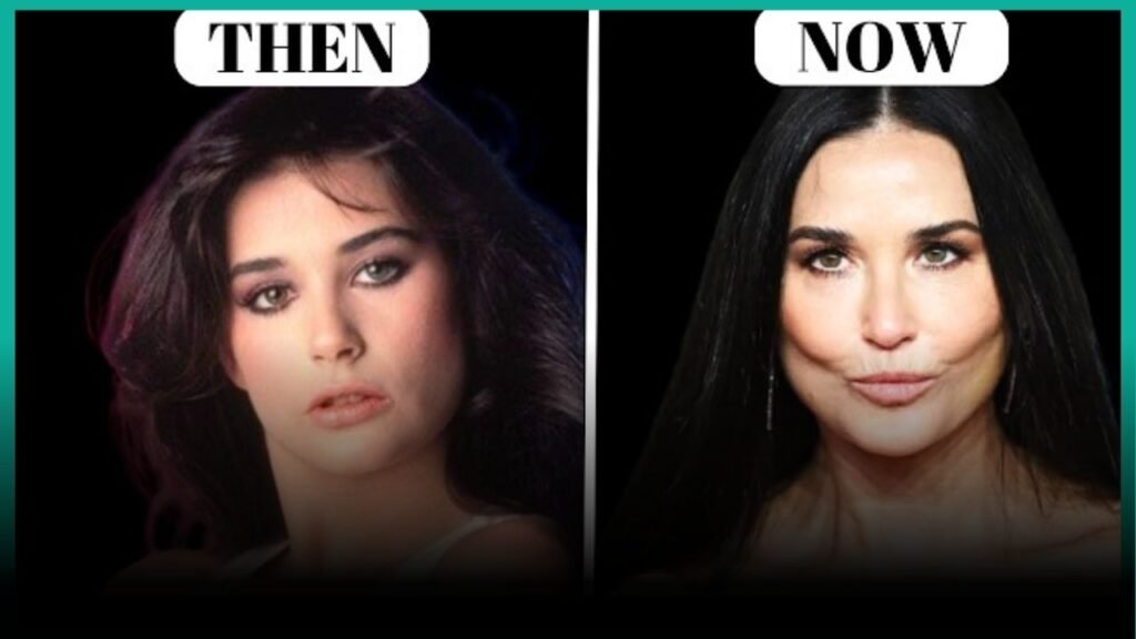 demi moore plastic surgery