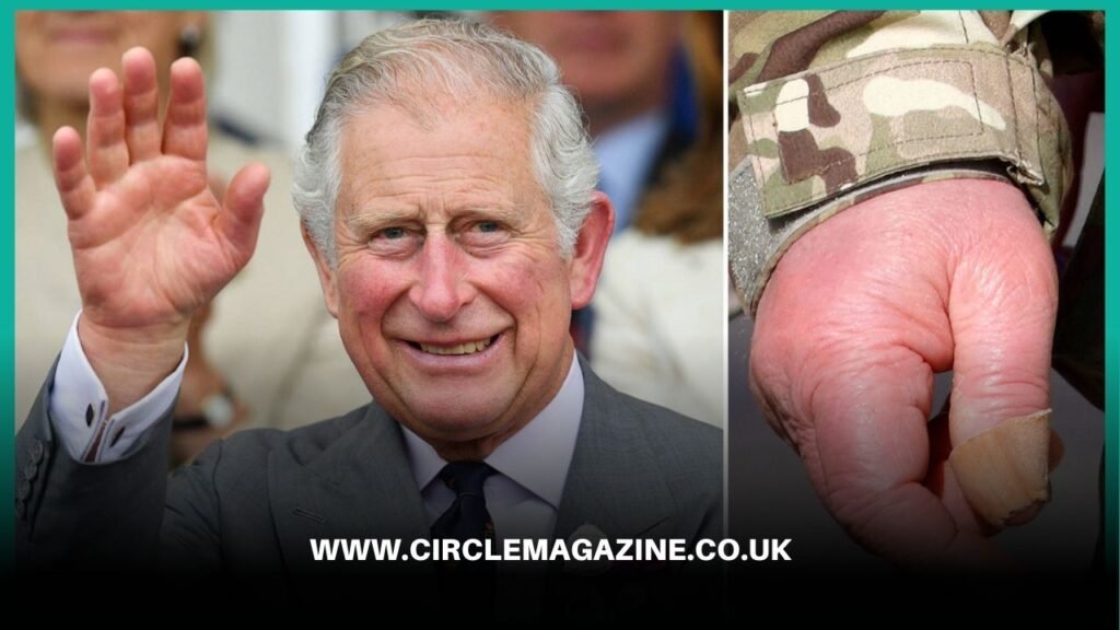 prince charles hands , prince charles fingers