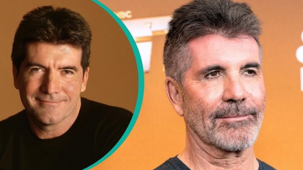 Simon Cowell Plastic Surgery Explained for Fans: What Is Known So Far simon cowell plastic surgery