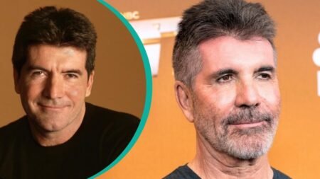 Simon Cowell Plastic Surgery Explained for Fans: What Is Known So Far simon cowell plastic surgery